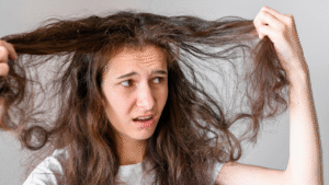 Mulher com uma expressão decepcionada, com o seu cabelo opaco. Descubra tudo sobre Porosidade Capilar